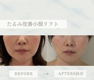 ソラ(Sola)