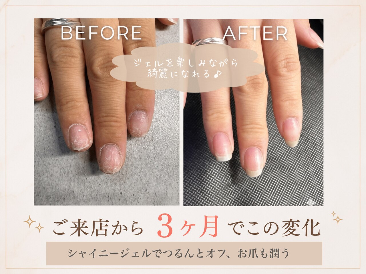 ネイルゴーゴー(NAIL55)｜ホットペッパービューティー