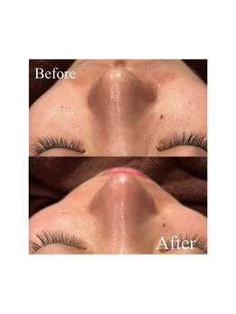 ホワイトワックス 京都四条烏丸(WHITE WAX)/《全顔》フェイシャルワックス