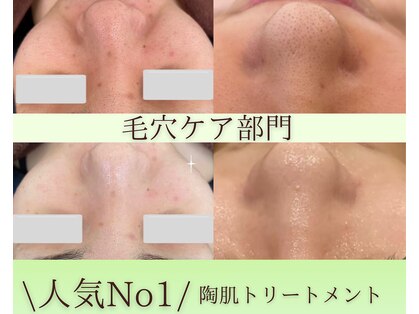 ファシル(Facile)の写真