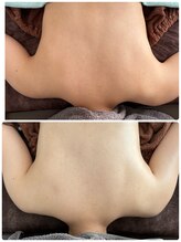 ラリール(Larire)/大切な挙式前に