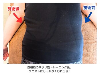 ラシュシュ/ビフォーアフター