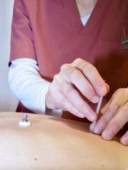 首・肩のつらさを改善したい