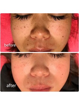 ベルマタン(belle matin)/光で叶える透明美肌