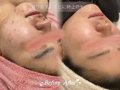 ココマヒナ(coco de mahina)の写真