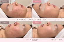サロンドラヴィン(salon de Lovin)