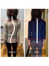 アウル なかもず店(OWL)/姿勢矯正ビフォーアフター