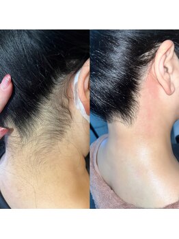 ナビレラ 自由が丘(Navillera)/プレミアム構造ワックス