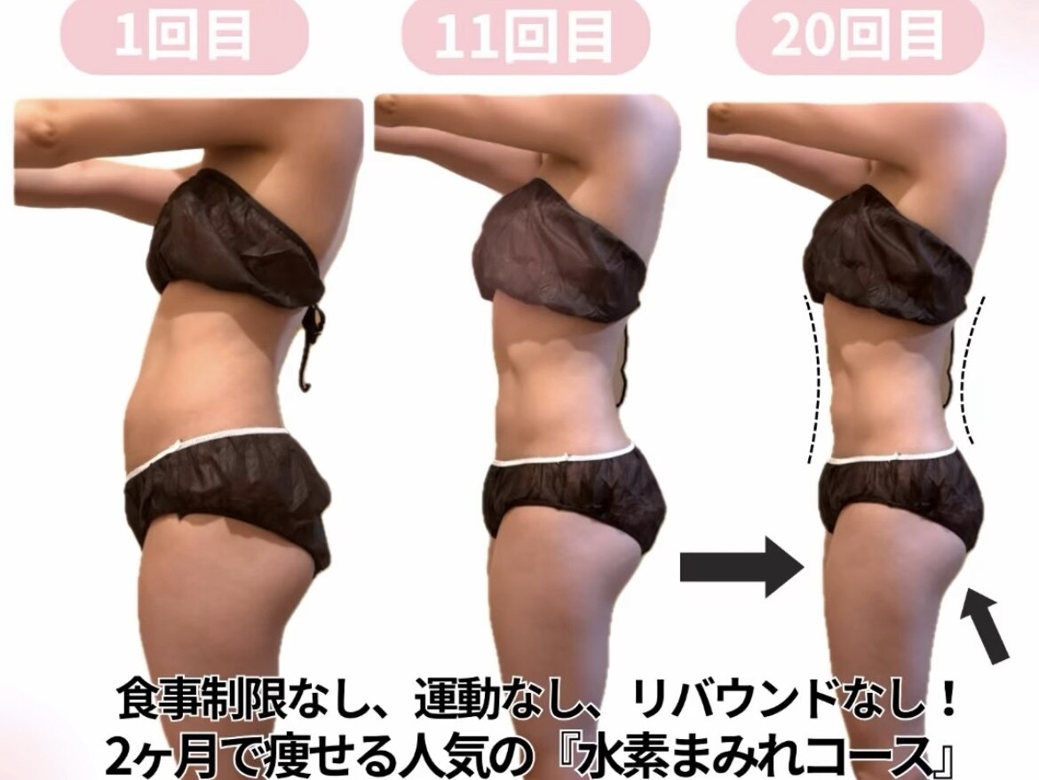 ヨサパーク リナータ(YOSA PARK Rinata)｜ホットペッパービューティー