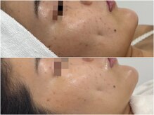 その場で効果が実感できる施術もあります