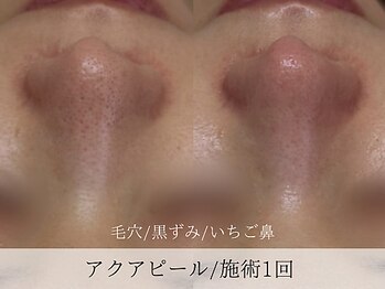 ミューズ バイ エス(MUSE BY S)/