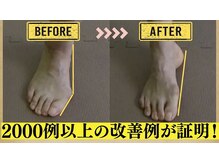 中央治療院/姿勢を変えただけで足は変わる