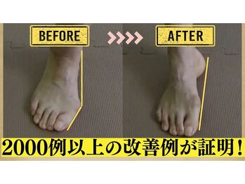 中央治療院/姿勢を変えただけで足は変わる