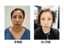 マシェリ(ma-che'rie)/無料カウンセリング実施中！