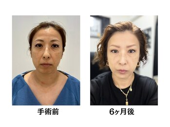 マシェリ(ma-che'rie)/無料カウンセリング実施中！