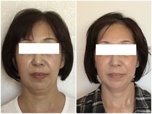 ウェリナ平和堂長久手院/小顔矯正/骨盤矯正/美脚サロン