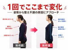 ボディメイクラボ(ボディメイクLABO)/堺駅│姿勢改善の1回目写真◎