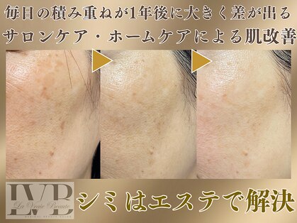 ラヴレボーテ(La Vraie Beaute)の写真