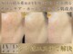ラヴレボーテ(La Vraie Beaute)の写真