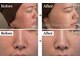 ベル 泉中央(Belle)の写真