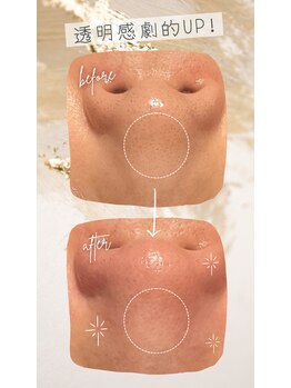 サロン ココ(COCO)/毛穴洗浄