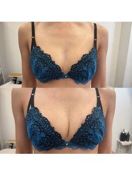 ジュエルリング(Jewel Ring)/バストアップ恵比寿・渋谷