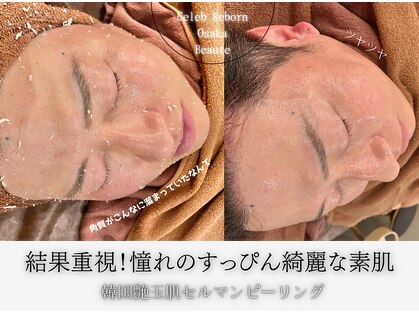 セレブリボーン 大阪ボーテの写真