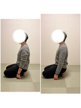 ツリー鍼灸整骨院 吹田店(TREE鍼灸整骨院)/巻き肩・猫背の姿勢改善に！