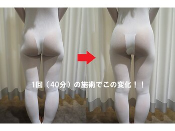 ココラ/エンダモロジー1回での変化！！