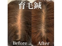 美容鍼灸サロン ユールーム(YOUROOM)の雰囲気（男女問わず髪のボリュームや抜け毛でお悩みの方へ！）