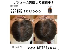 サンシー整体(SunCY整体)/4０代女性