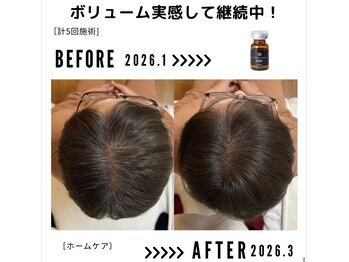 サンシー整体(SunCY整体)/4０代女性