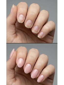 キレイエ ネイルズ(KIREIE NAILS)の写真/深爪の育成を叶える美爪コース+ネイルメニューが豊富!自爪のお悩みケアで、”ちょっと自信”♪