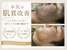 ルビー 六本木店(Ruby)の雰囲気（自社開発＆成分にこだわった『ハーブピーリング』で韓国美肌へ♪）