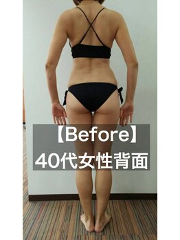 24ダイヤモンドジム 西宮店(24 DIAMOND GYM)/【Before】40代お客様背面