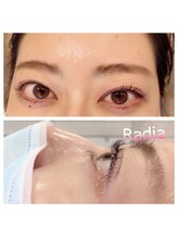 ラディア(Radia)/