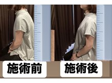 もみまる 水前寺店の雰囲気（猫背や辛いコリ、ベテランスタッフにお任せください！）