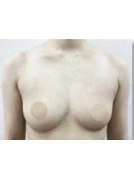 バストラインを整えたい