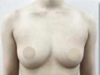 サンバイエム(#3/M)の写真/本気でバストを変えたい方必見☆バストのお悩みは#3/M【サンバイエム】にお任せ!憧れのふっくら美乳に◎