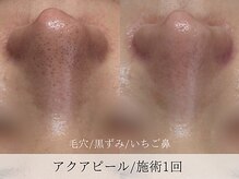 ミューズ バイ エス(MUSE BY S)/