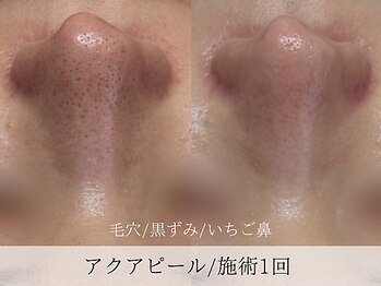 ミューズ バイ エス(MUSE BY S)/