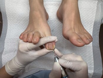 ドクターネイル爪革命　岐阜店｜足の爪切り・巻き爪・魚の目・角質・肥厚爪の足専門店の写真/悩みから解放☆どこに相談すればいいか迷う爪トラブルは当店へ！