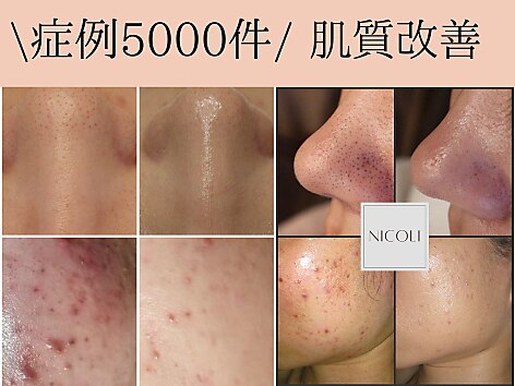 ニコリ(NICOLI)｜ホットペッパービューティー