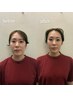 【学割U24】他撮りでも小顔!SNS映え間違え無しの徹底小顔矯正+整体☆¥3980