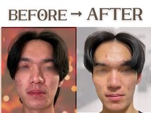 美容の宝石箱の雰囲気（【肌改善実績多数】20代/半年後/敏感肌とニキビ肌でのお悩み）