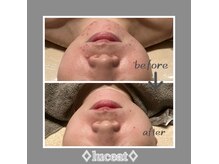 ルーチェット(luceat)