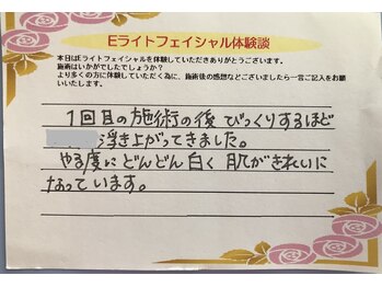 ビエル(Bielle)/シミケア　口コミ