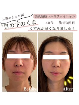 サロンニコ(salon Nico)/顔筋コルギ90分フェイシャル