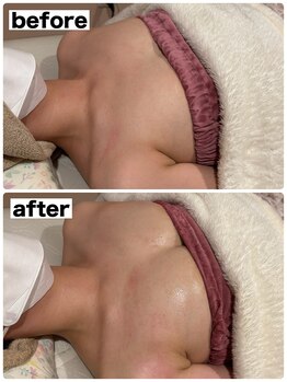 マイントゥー(mine too)/