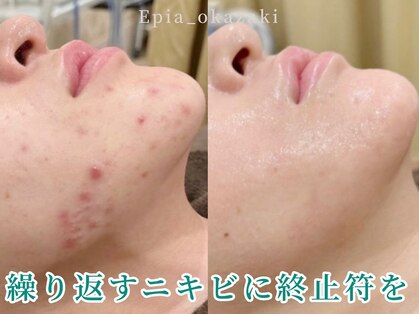 エピア 岡崎店(Epia)の写真
